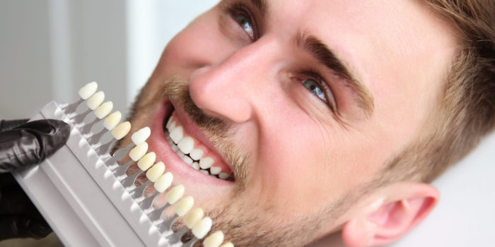 Young man choosing color of teeth at dentist
