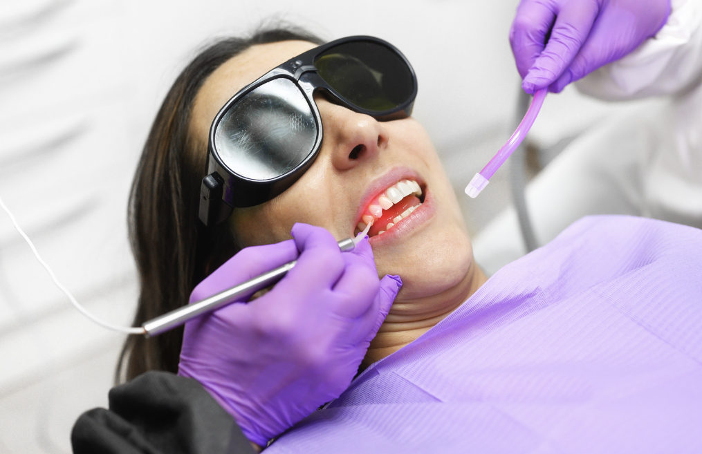 laser_dentistry_los_angeles